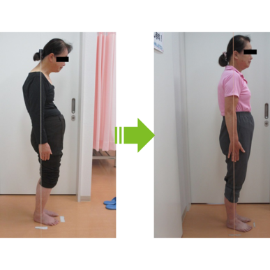 【木村式姿勢矯正法】