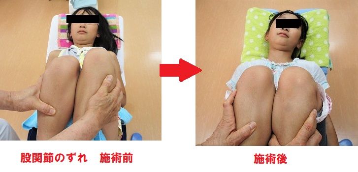 ビフォーアフター