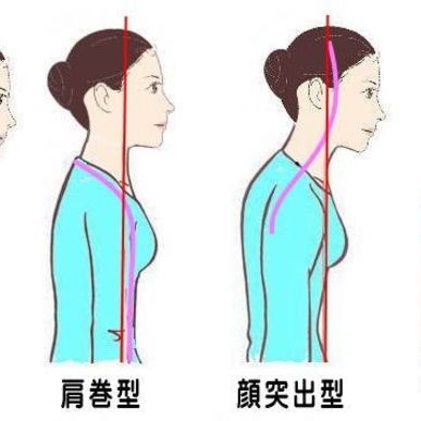 本厚木駅近のひかり整体院で猫背改善の治療