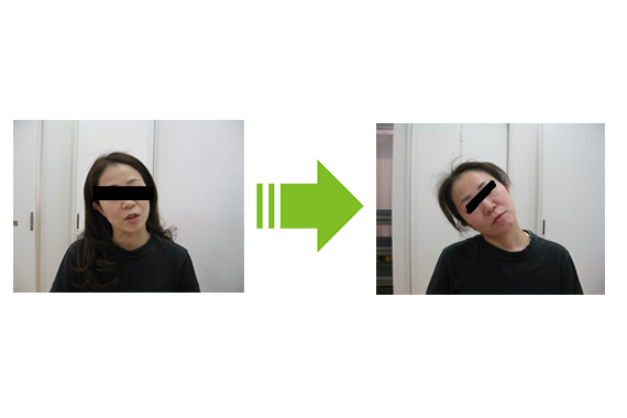 寝違え