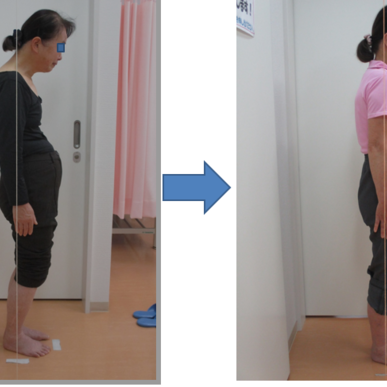 友達に姿勢が良くなったわねと言ってもらえるようになりました。